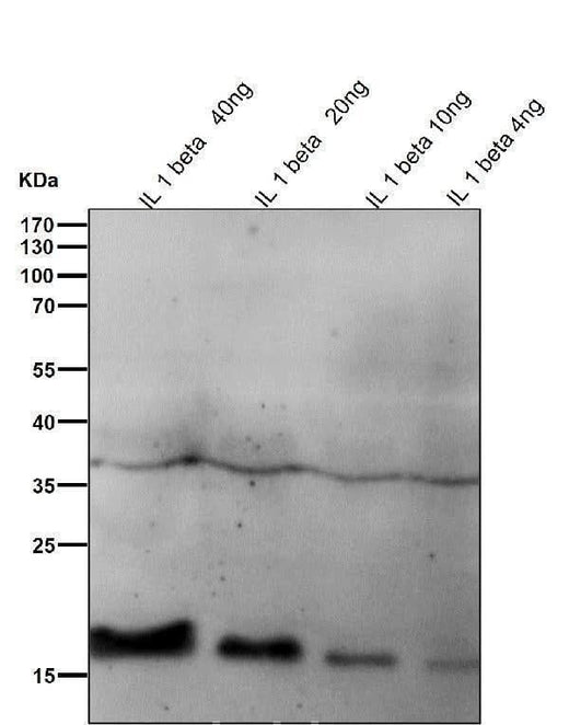 Anti-IL1 beta Rabbit Monoclonal Antibody Boster Bio