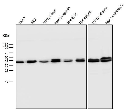Anti-ERK1/2 MAPK3 Rabbit Monoclonal Antibody Boster Bio