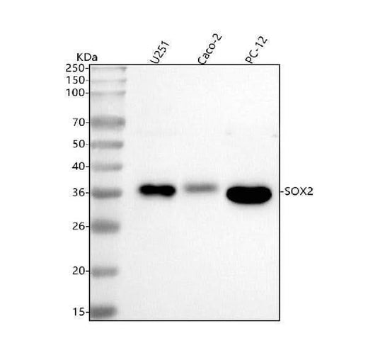 Anti-SOX2 Rabbit Monoclonal Antibody Boster Bio