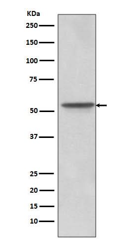 Anti-Src Rabbit Monoclonal Antibody Boster Bio