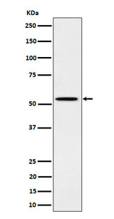 Anti-Phospho-Src (Y529) Rabbit Monoclonal Antibody Boster Bio