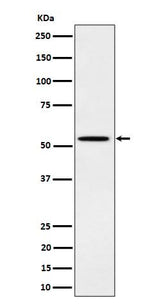 Anti-Phospho-Src (Y529) Rabbit Monoclonal Antibody Boster Bio