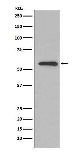 Anti-Glucose 6 phosphate isomerase Rabbit Monoclonal Antibody Boster Bio