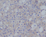 Anti-PD-L1 (CD274) Rabbit Monoclonal Antibody Boster Bio