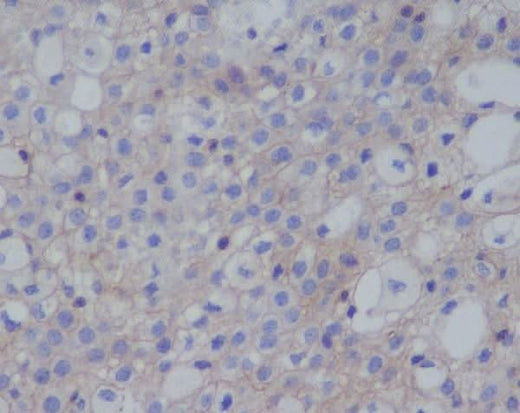 Anti-PD-L1 (CD274) Rabbit Monoclonal Antibody Boster Bio