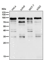 Anti-SP1 Rabbit Monoclonal Antibody Boster Bio