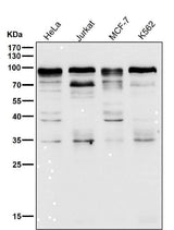 Anti-SP1 Rabbit Monoclonal Antibody Boster Bio