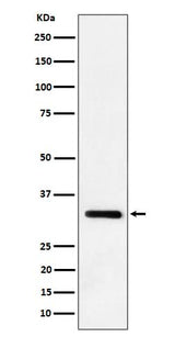 Anti-IL-33 Rabbit Monoclonal Antibody Boster Bio