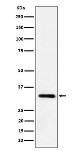 Anti-IL-33 Rabbit Monoclonal Antibody Boster Bio