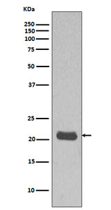 Anti-GTPase HRAS Rabbit Monoclonal Antibody Boster Bio