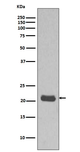 Anti-GTPase HRAS Rabbit Monoclonal Antibody Boster Bio