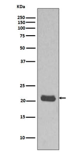 Anti-GTPase HRAS Rabbit Monoclonal Antibody Boster Bio