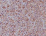 Anti-IRF7 Rabbit Monoclonal Antibody Boster Bio