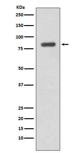 Anti-IKK beta IKBKB Rabbit Monoclonal Antibody Boster Bio