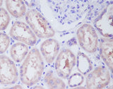 Anti-IKK beta IKBKB Rabbit Monoclonal Antibody Boster Bio
