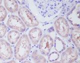 Anti-IKK beta IKBKB Rabbit Monoclonal Antibody Boster Bio