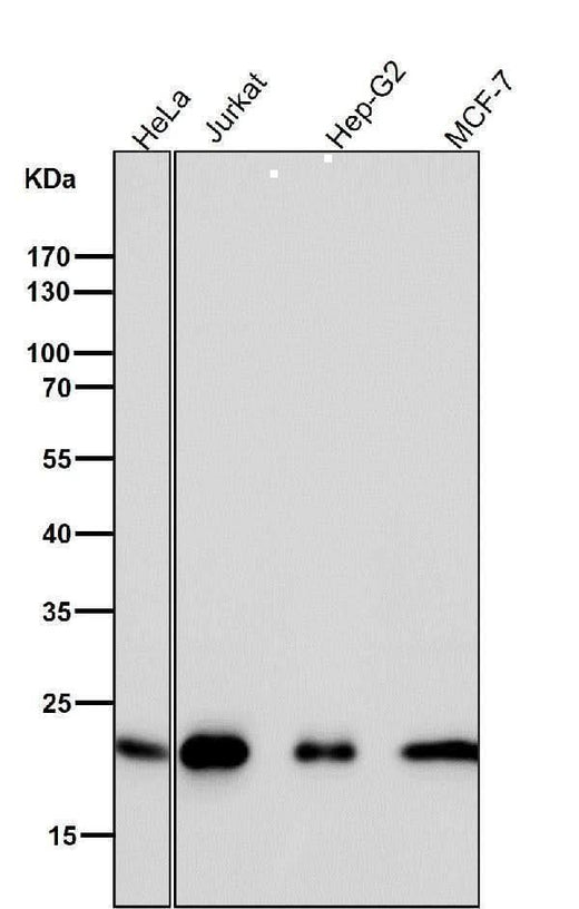 Anti-CDC42 Rabbit Monoclonal Antibody Boster Bio