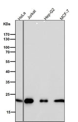 Anti-CDC42 Rabbit Monoclonal Antibody Boster Bio