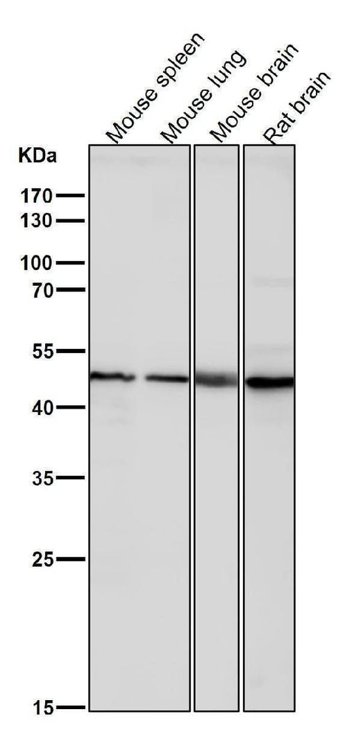 Anti-KLF4/Gklf Rabbit Monoclonal Antibody Boster Bio