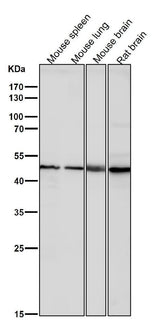 Anti-KLF4/Gklf Rabbit Monoclonal Antibody Boster Bio