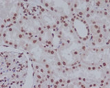 Anti-Cleaved PARP PARP1 Rabbit Monoclonal Antibody Boster Bio