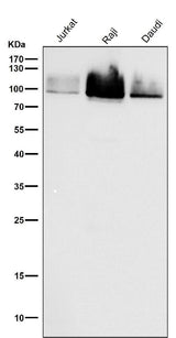 Anti-Cleaved PARP PARP1 Rabbit Monoclonal Antibody Boster Bio