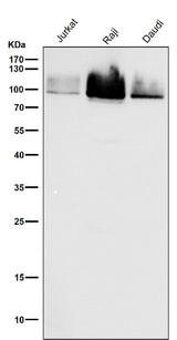 Anti-Cleaved PARP PARP1 Rabbit Monoclonal Antibody Boster Bio