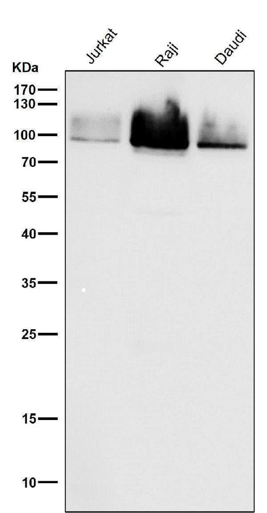 Anti-Cleaved PARP PARP1 Rabbit Monoclonal Antibody Boster Bio
