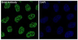 Anti-Brd4 Rabbit Monoclonal Antibody Boster Bio