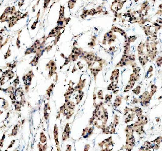 Anti-MLH1 Rabbit Monoclonal Antibody Boster Bio