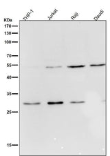 Anti-Parkin PARK2 Rabbit Monoclonal Antibody Boster Bio