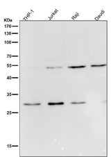 Anti-Parkin PARK2 Rabbit Monoclonal Antibody Boster Bio
