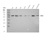 Anti-CBS Antibody Picoband® (monoclonal, 5B5D7 Boster Bio