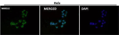 Anti-CTCF Rabbit Monoclonal Antibody Boster Bio