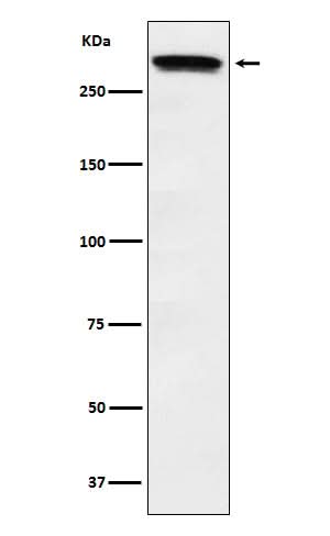Anti-Huntingtin Monoclonal Antibody Boster Bio