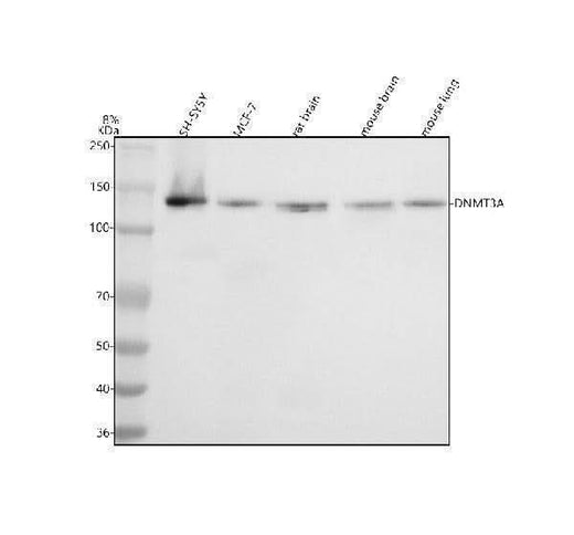 Anti-Dnmt3a Rabbit Monoclonal Antibody Boster Bio