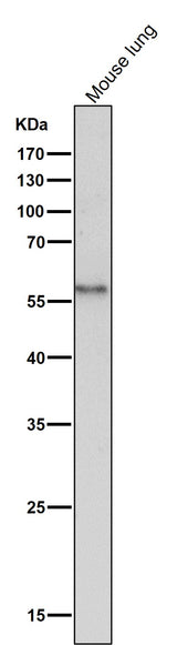 Anti-CD14 Rabbit Monoclonal Antibody Boster Bio