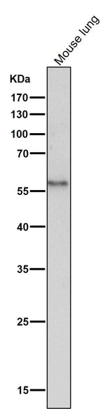 Anti-CD14 Rabbit Monoclonal Antibody Boster Bio