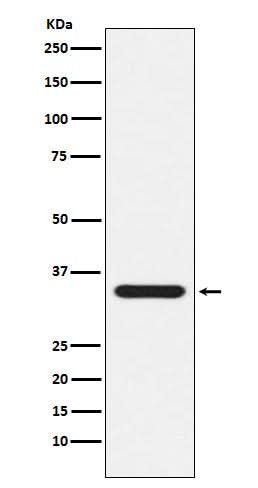 Anti-Presenilin 1 Monoclonal Antibody Boster Bio