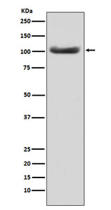 Anti-MSH2 Monoclonal Antibody Boster Bio