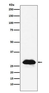Anti-Carbonic anhydrase 2 Rabbit Monoclonal Antibody Boster Bio