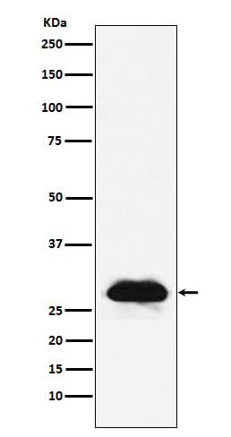 Anti-Carbonic anhydrase 2 Rabbit Monoclonal Antibody Boster Bio