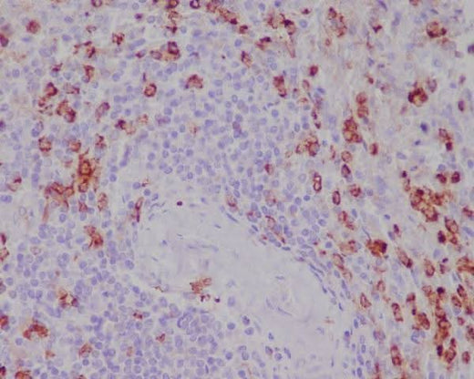 Anti-CD11b ITGAM Rabbit Monoclonal Antibody Boster Bio
