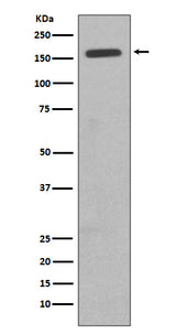 Anti-CD11b ITGAM Rabbit Monoclonal Antibody Boster Bio