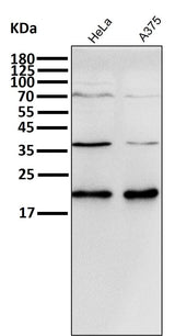 Anti-p21 CDKN1A Rabbit Monoclonal Antibody Boster Bio