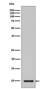 Anti-IGF1/Igf I Rabbit Monoclonal Antibody Boster Bio