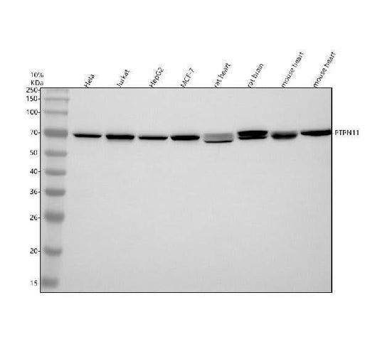 Anti-SHP2 PTPN11 Rabbit Monoclonal Antibody Boster Bio