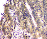 Anti-SHP2/PTPN11 Antibody Picoband® (monoclonal, 2E6 Boster Bio