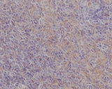 Anti-FAK PTK2 Rabbit Monoclonal Antibody Boster Bio