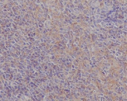 Anti-FAK PTK2 Rabbit Monoclonal Antibody Boster Bio